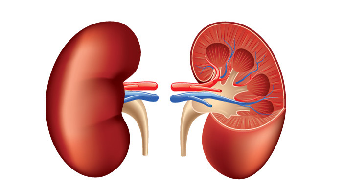 কিডনিতে পাথর হওয়ার ৮ কারণ