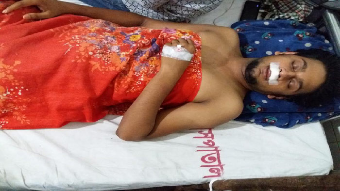 ঢামেকে চিকিৎসাধীন জবি শিক্ষার্থী সোহেল। ছবি একুশে টিভি অনলাইন ঢামেকে চিকিৎসাধীন জবি শিক্ষার্থী সোহেল। ছবি একুশে টিভি অনলাইন