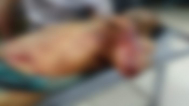 নাটোরে আ’লীগ কর্মীকে কুপিয়ে জখম