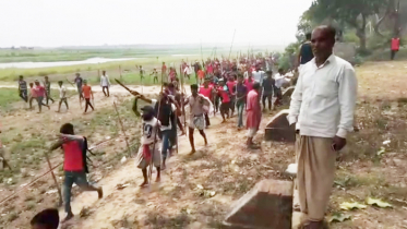 কাটা পা নিয়ে মধ্যযুগীয় উল্লাস!