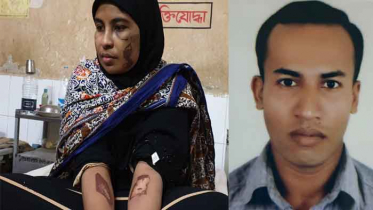 নোয়াখালীতে যৌতুকের জন্য স্ত্রীর শরীর ঝলসে দিয়েছে স্বামী