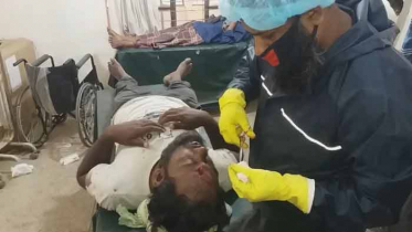 ক্রিকেট খেলাকে কেন্দ্র করে দু‘পক্ষে সংঘর্ষে নারীসহ আহত ৩৫ 