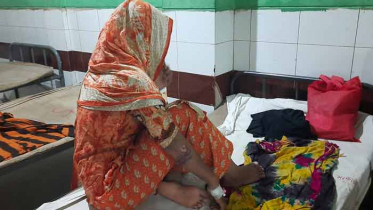 যৌতুক না দেয়ায় ঝলসে দেয়া হলো গৃহবধূর শরীর