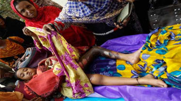 বিদ্যালয়ের মাঠে আগুন ধরাতে গিয়ে তৃতীয় শ্রেণির ছাত্রী দগ্ধ 