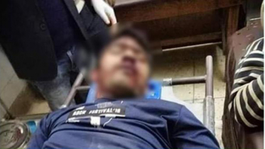 ফারাবির অবস্থার উন্নতি, খোলা হয়েছে লাইফ সাপোর্ট