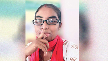 যেভাবে ঘুরে দাঁড়ালেন একজন অ্যাসিড-আক্রান্ত