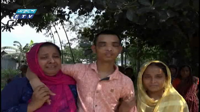 মজুরি চাওয়ার অপরাধে চোখ উপড়ে ফেললো মিলনের (ভিডিও)