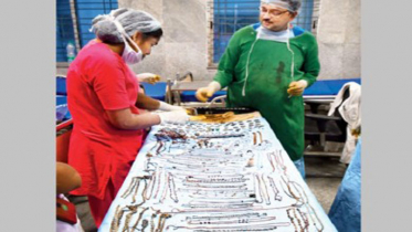 তরুণীর পেটে মিলল ১ কেজি ৬০০ গ্রাম অলংকার!