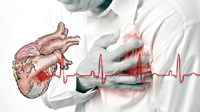 হার্ট অ্যাটাকে যে বিষয়গুলো উপেক্ষা করার উপায় নেই