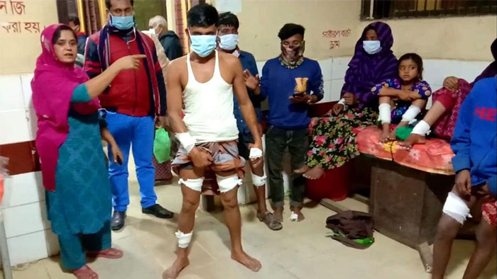 ব্রাহ্মণবাড়িয়া জেনারেল হাসপাতালে আহতরা। ছবি: একুশে টেলিভিশন ব্রাহ্মণবাড়িয়া জেনারেল হাসপাতালে আহতরা। ছবি: একুশে টেলিভিশন