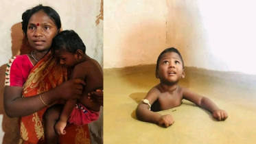টাকার অভাবে আড়াই ফুট গর্তেই চলছে গোপালের চিকিৎসা