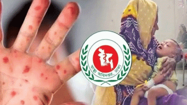 হাম উপসর্গে আরও ৬ প্রাণহানি, নতুন ভার্তি ১,৩৯৩ হাম উপসর্গে আরও ৬ প্রাণহানি, নতুন ভার্তি ১,৩৯৩