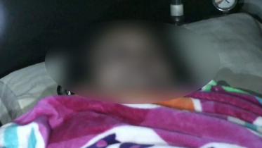 তালাক দেয়ায় সাবেক স্ত্রীকে এসিড নিক্ষেপ  