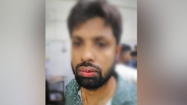 বখাটেদের হামলায় কলেজ শিক্ষক রক্তাক্ত 