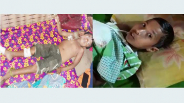 কুড়িয়ে পাওয়া বোমার বিস্ফোরণে ২ শিশু আহত