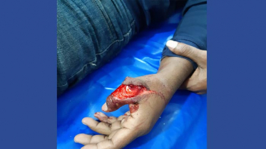 নাসিরনগরে মাইক্রোবাসে ডাকাতি, আহত ১ 