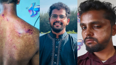 কোটা আন্দোলনে দায়িত্ব পালনকালে দুর্বৃত্তদের হামলার শিকার ইটিভির সাংবাদিক