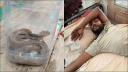 ছোবলের পর জীবন্ত গোখরা সাপ নিয়েই হাসপাতালে যুবক