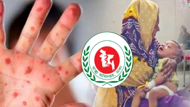 হাম ও উপসর্গে মৃত্যু বেড়ে ৮২৮, নতুন আক্রান্ত ৯০৪