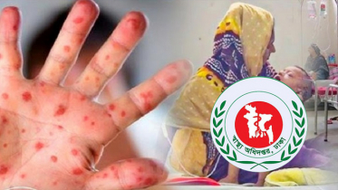 হাম উপসর্গে আরও ৭ শিশুর মৃত্যু, আক্রান্ত ৯৮১ হাম উপসর্গে আরও ৭ শিশুর মৃত্যু, আক্রান্ত ৯৮১