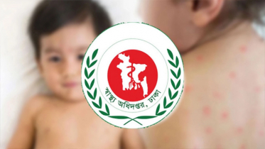 হাম উপসর্গে আরও ৩ শিশুর মৃত্যু, নতুন রোগী ১০৮০