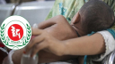 হাম উপসর্গে আরও ৬ শিশুর মৃত্যু, নতুন রোগী ১২৩১