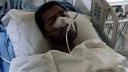 জ্ঞান ফিরেছে নুরের, ভেঙে গেছে নাকের হাড়