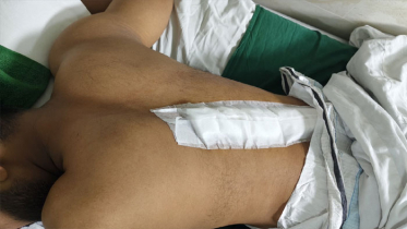 মোহাম্মদপুরে পুলিশ কর্মকর্তাকে ছুরিকাঘাত, লাগল ৪৩ সেলাই