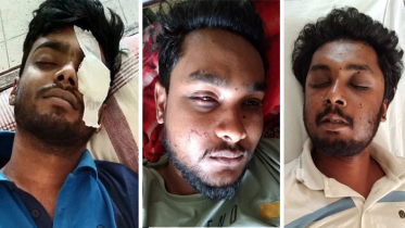রাবির আহত তিন ছাত্রকে পাঠানো হচ্ছে ঢাকায়