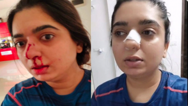 খাবার দিতে দেরি কেন বলতেই নাক ফাটিয়ে দিলেন বয়