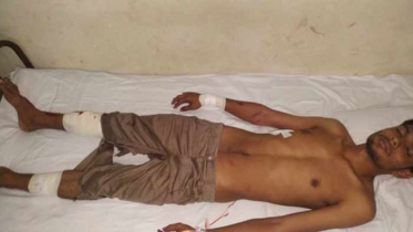 ছাত্রলীগ নেতার হাত-পায়ের রগ কাটল শিবির