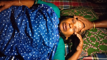 মাঙ্কিপক্সের উপসর্গ, চুয়াডাঙ্গায় আইসোলেশনে নারী