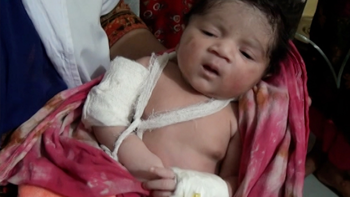 দুর্ঘটনায় অলৌকিকভাবে বেঁচে যাওয়া সেই কন্যা শিশুটি দুর্ঘটনায় অলৌকিকভাবে বেঁচে যাওয়া সেই কন্যা শিশুটি